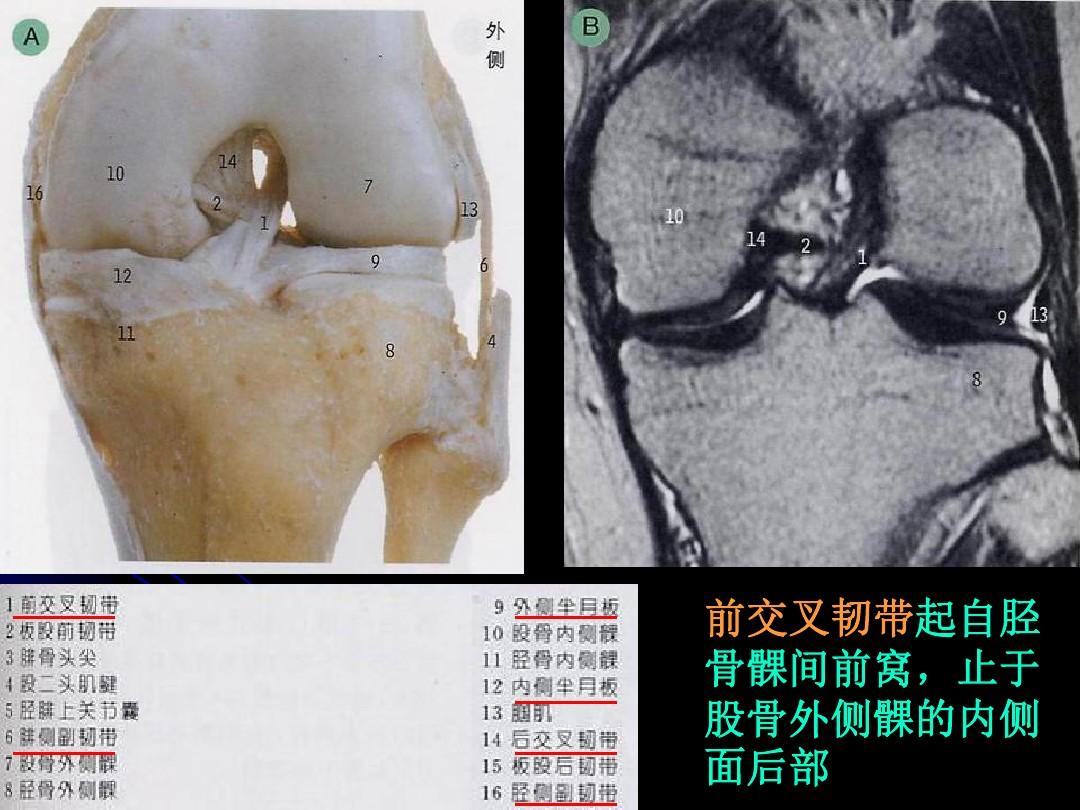 膝关节解剖及MRI诊断