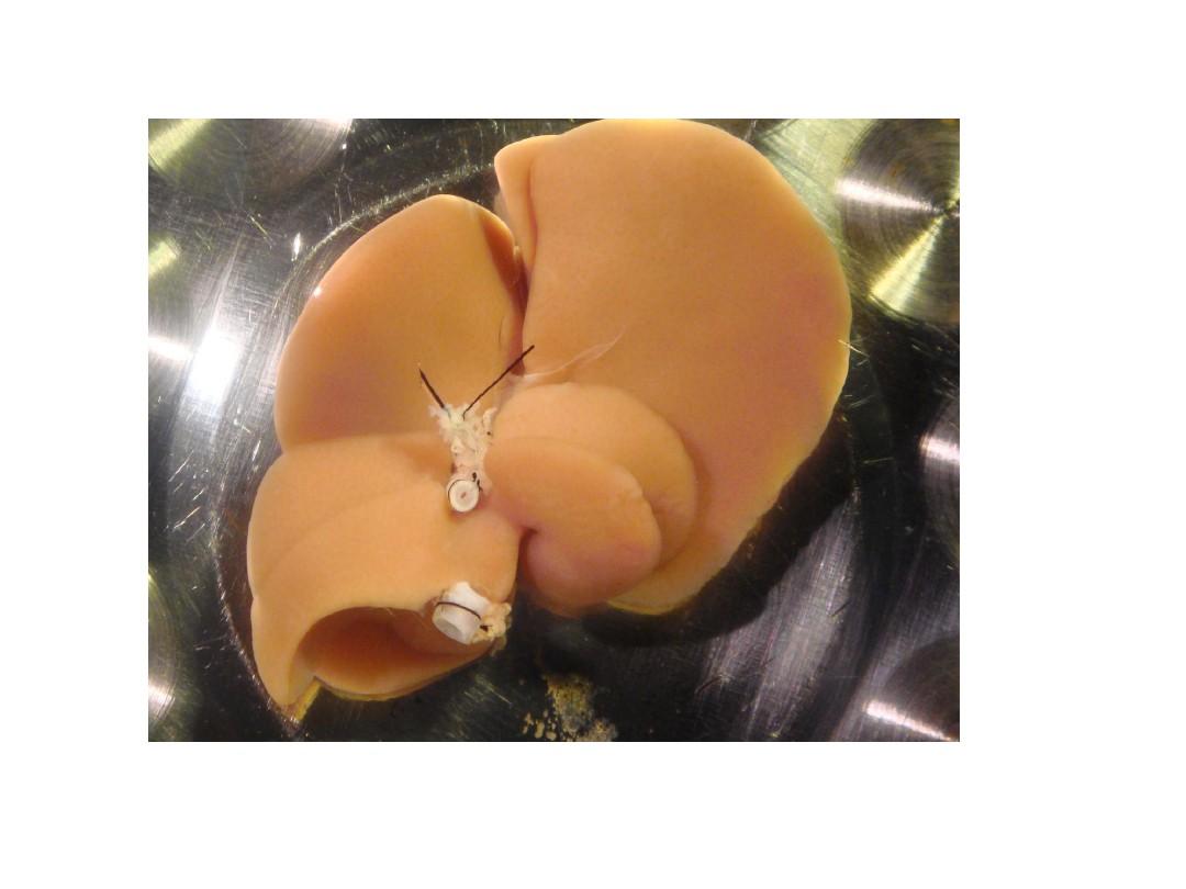 大鼠肝移植过程图