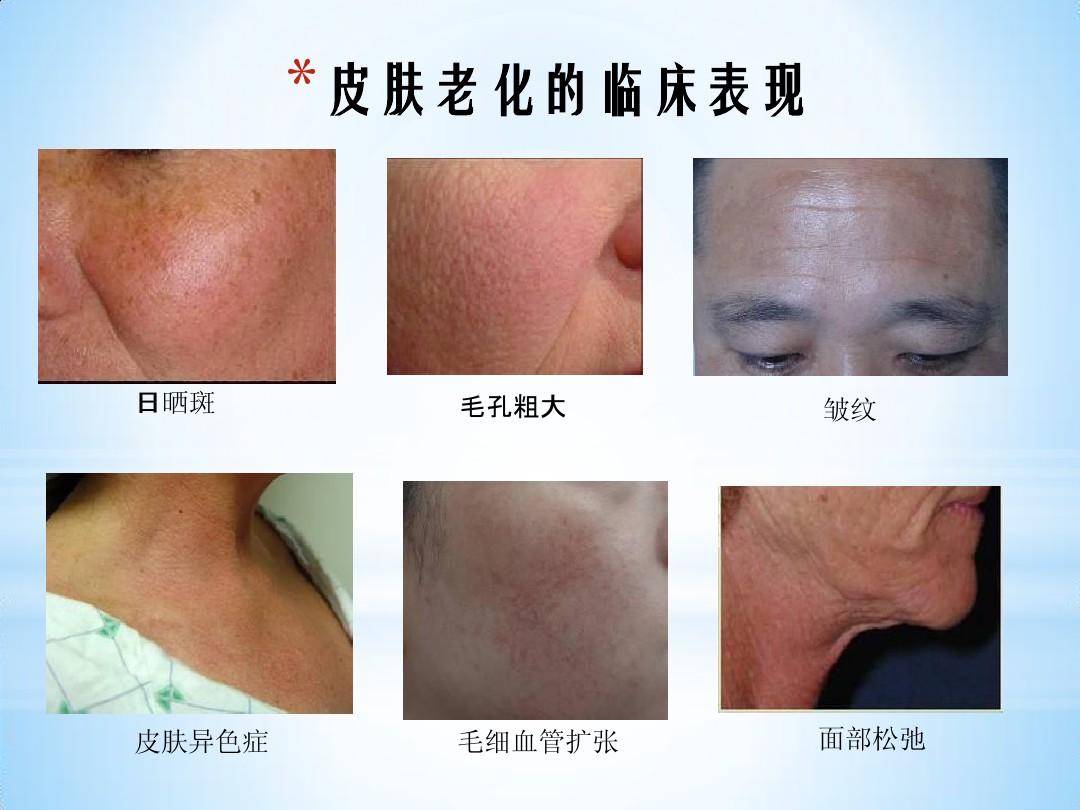 非手术皮肤年轻化治疗综合策略-赵小忠