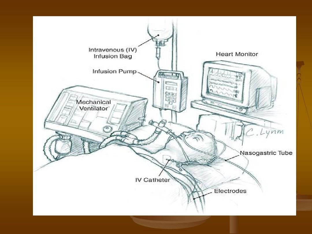 呼吸机基本模式与参数设置