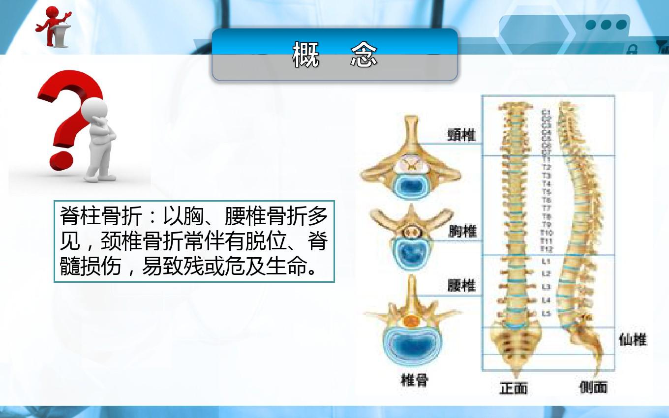 护士脊柱骨折及脊髓损伤病人的护理ppt