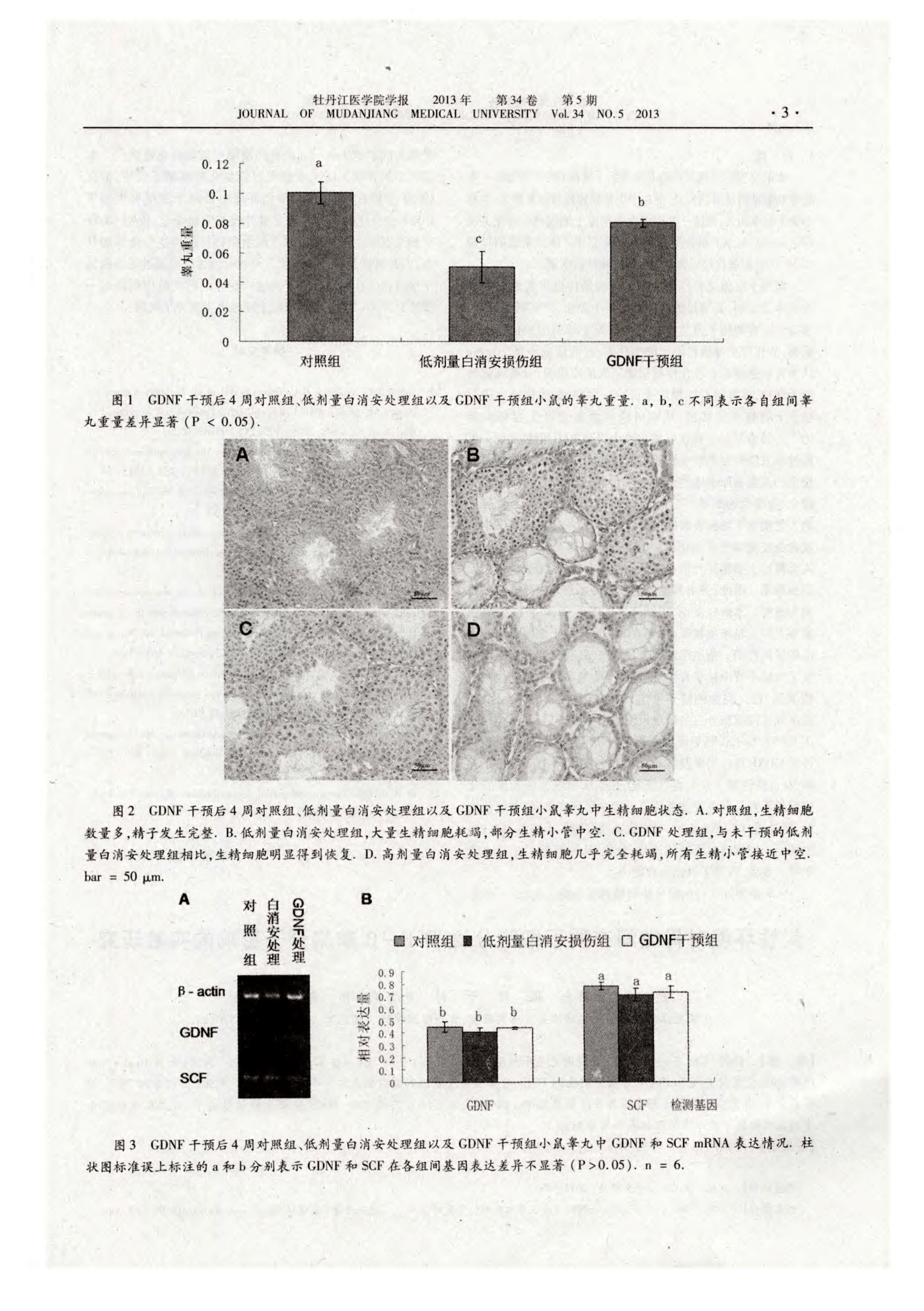 GDNF干预对化疗致精原干细胞耗竭小鼠生精细胞恢复效果的研究-论文