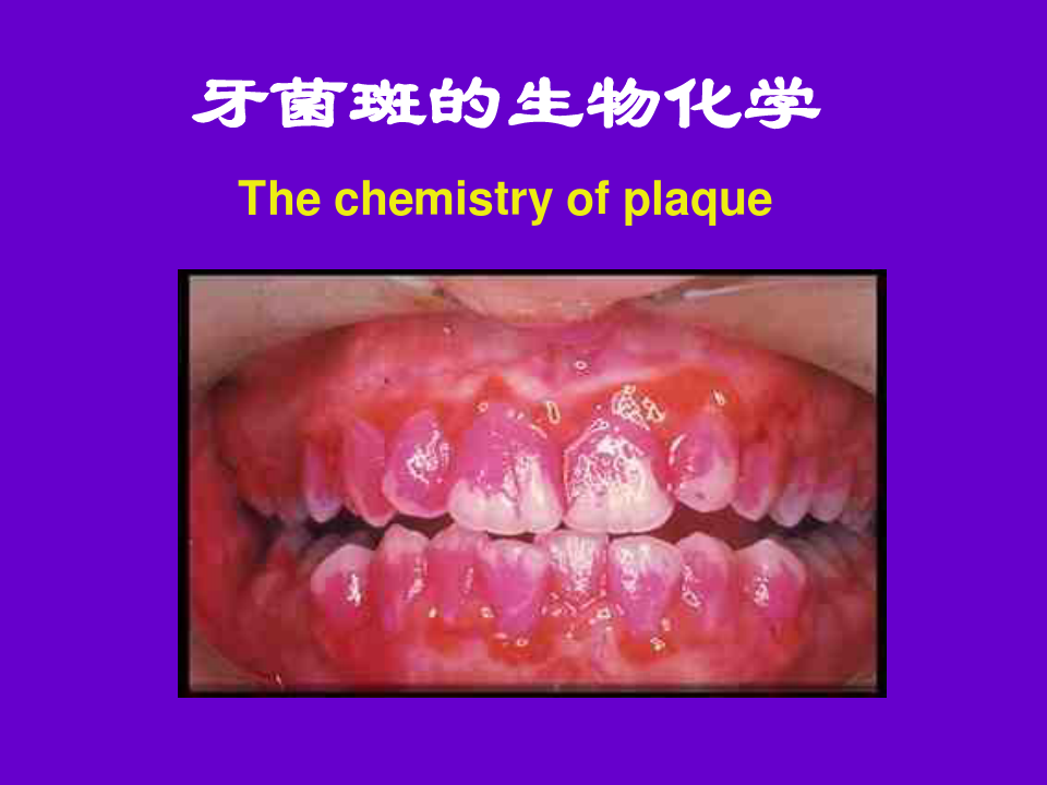 牙菌斑的生物化学