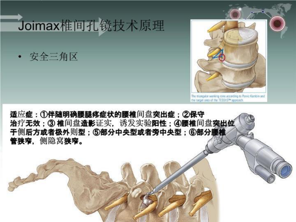 最新joimax椎间孔镜手术护理配合