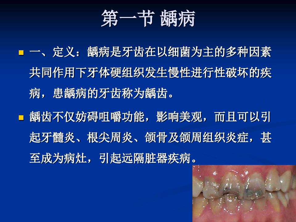 牙体牙周组织疾病