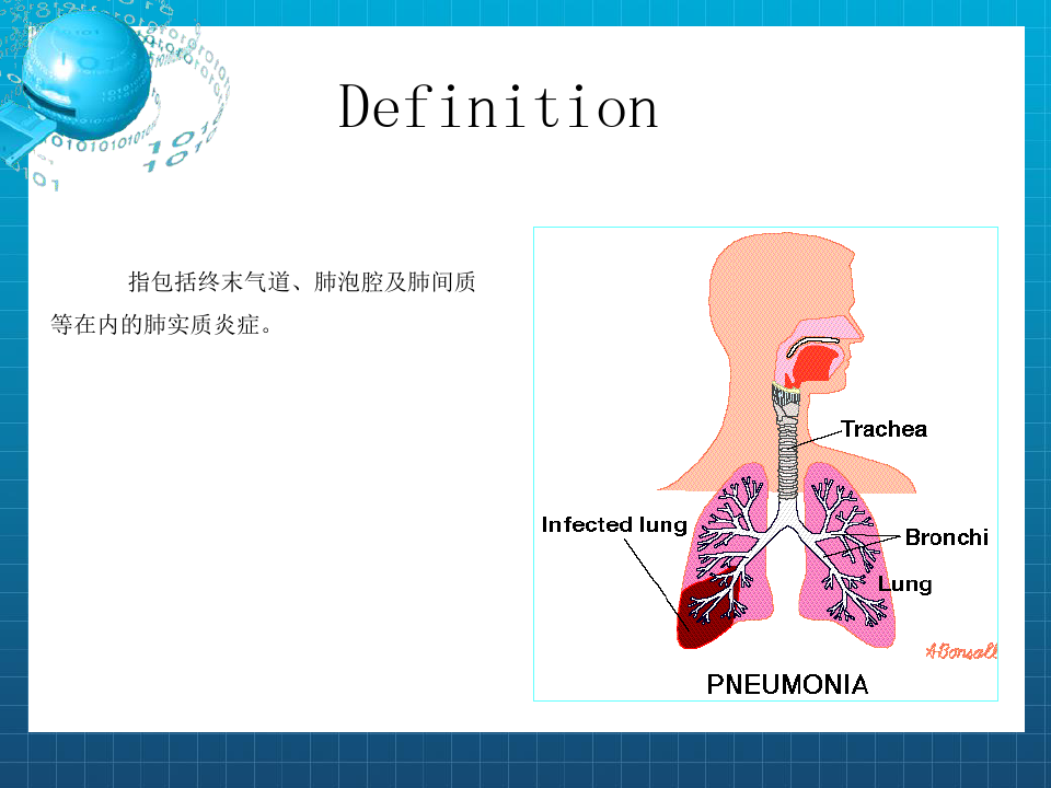 《肺部感染性疾病》PPT课件
