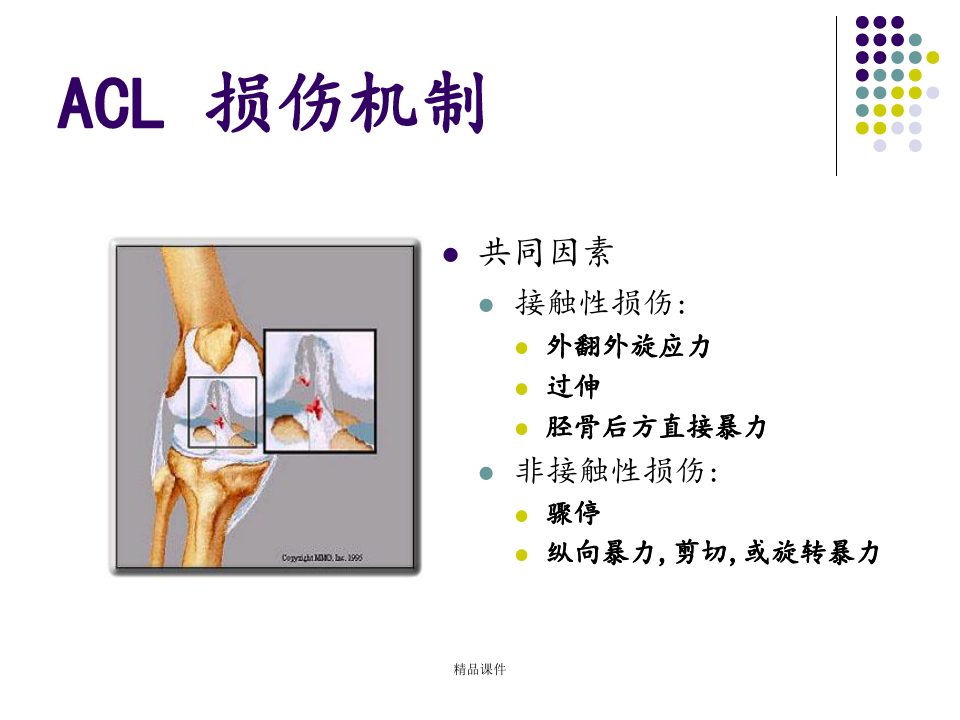 膝关节前交叉韧带损伤诊断与治疗ppt课件