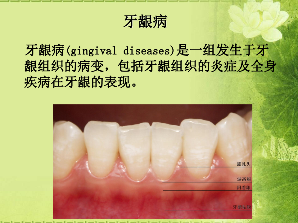 口腔科学：牙周疾病