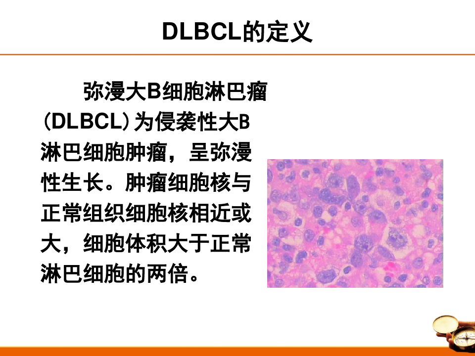 中国弥漫大B细胞淋巴瘤诊治指南