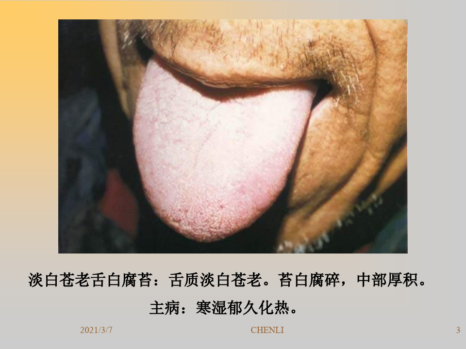 中医舌诊图片PPT课件
