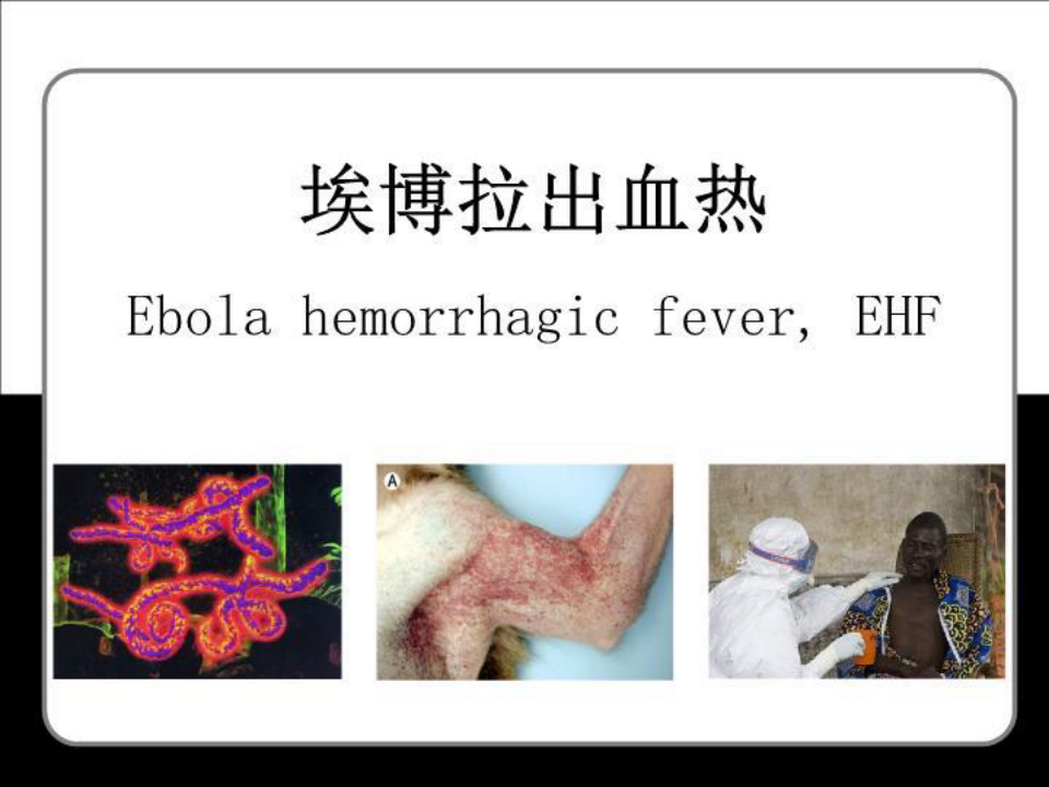 埃博拉出血热医学课件