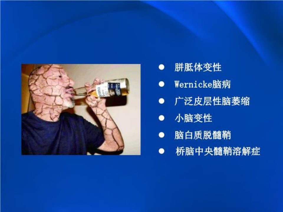 酒精中毒性脑病影像学表现