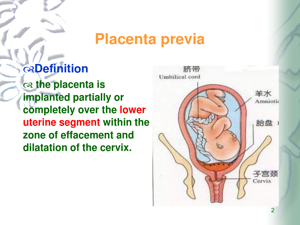 妇产科学课件：Placenta previa and Abruptio placenta