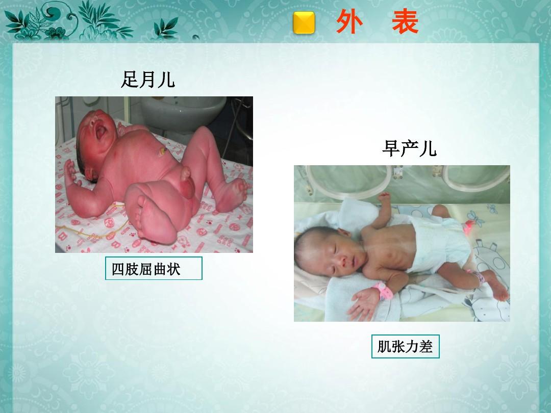 新生儿常见疾病识别与处理