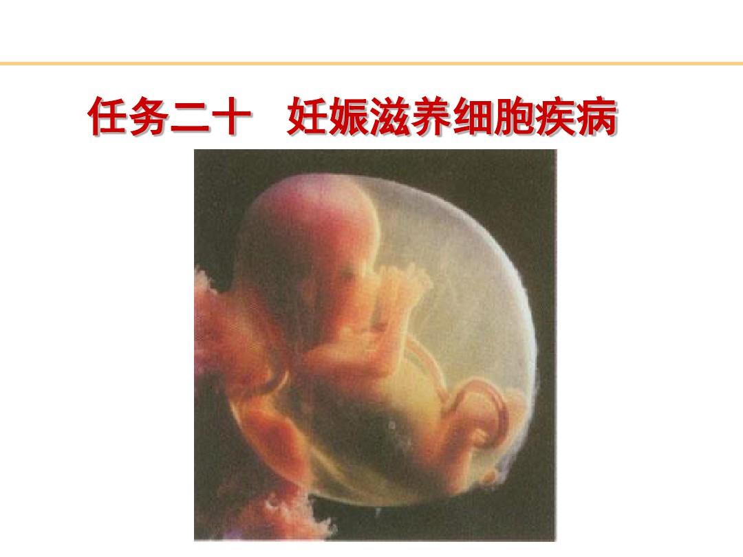 《妊娠滋养细胞疾病》PPT课件