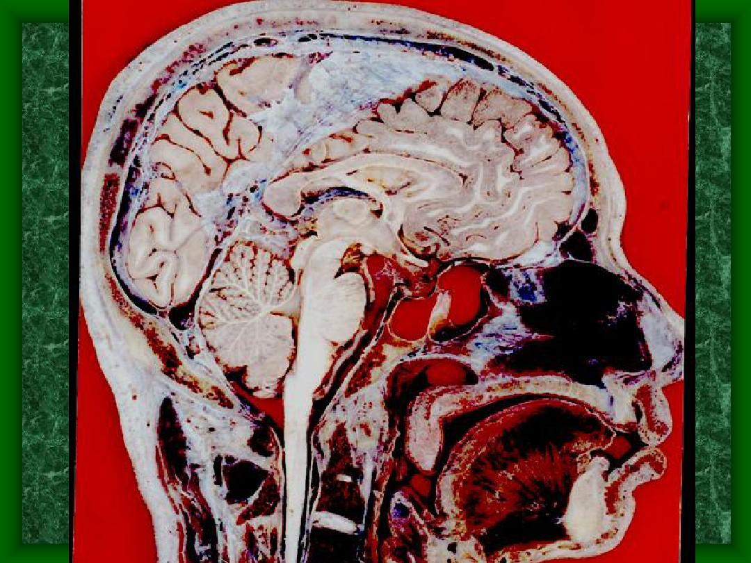 颅脑矢状断层解剖及MRI