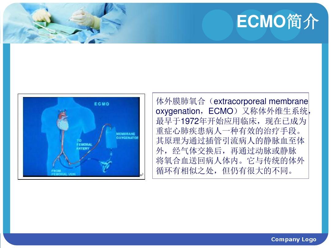 ECMO(体外膜肺氧合)