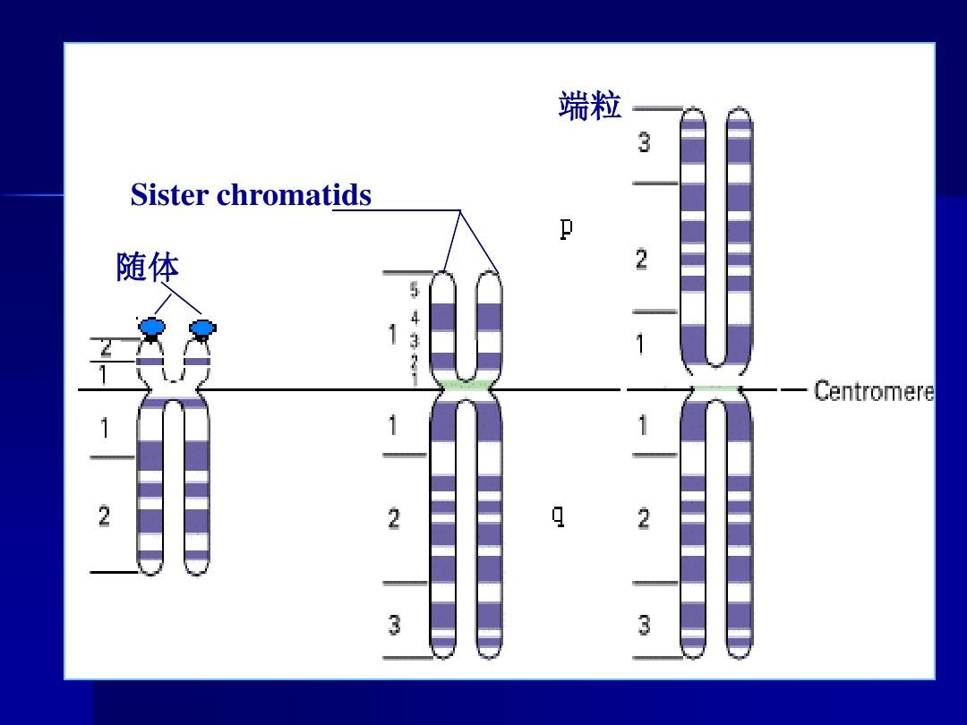 染色体带型