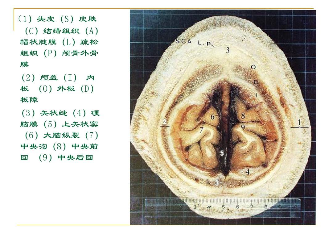 人体断层解剖图谱(大脑)