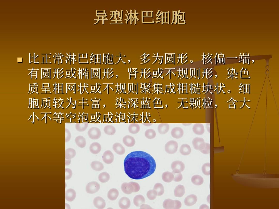 血液图谱之淋巴细胞系