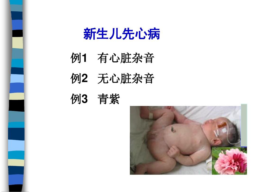 新生儿先天性心脏病 PPT课件