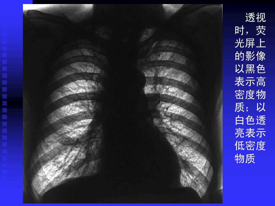 正常胸部影像学PPT