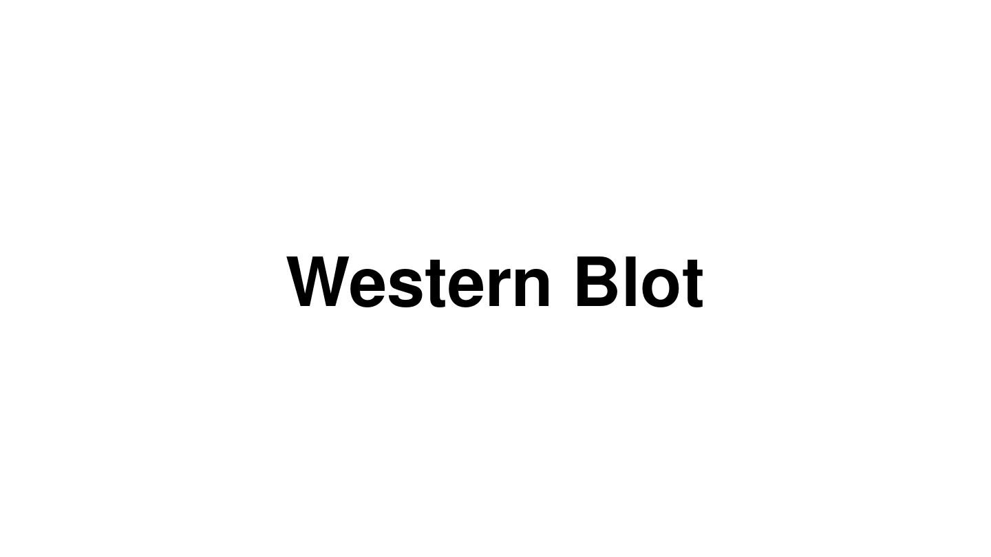 WB-Western Blot实验步骤及讲解