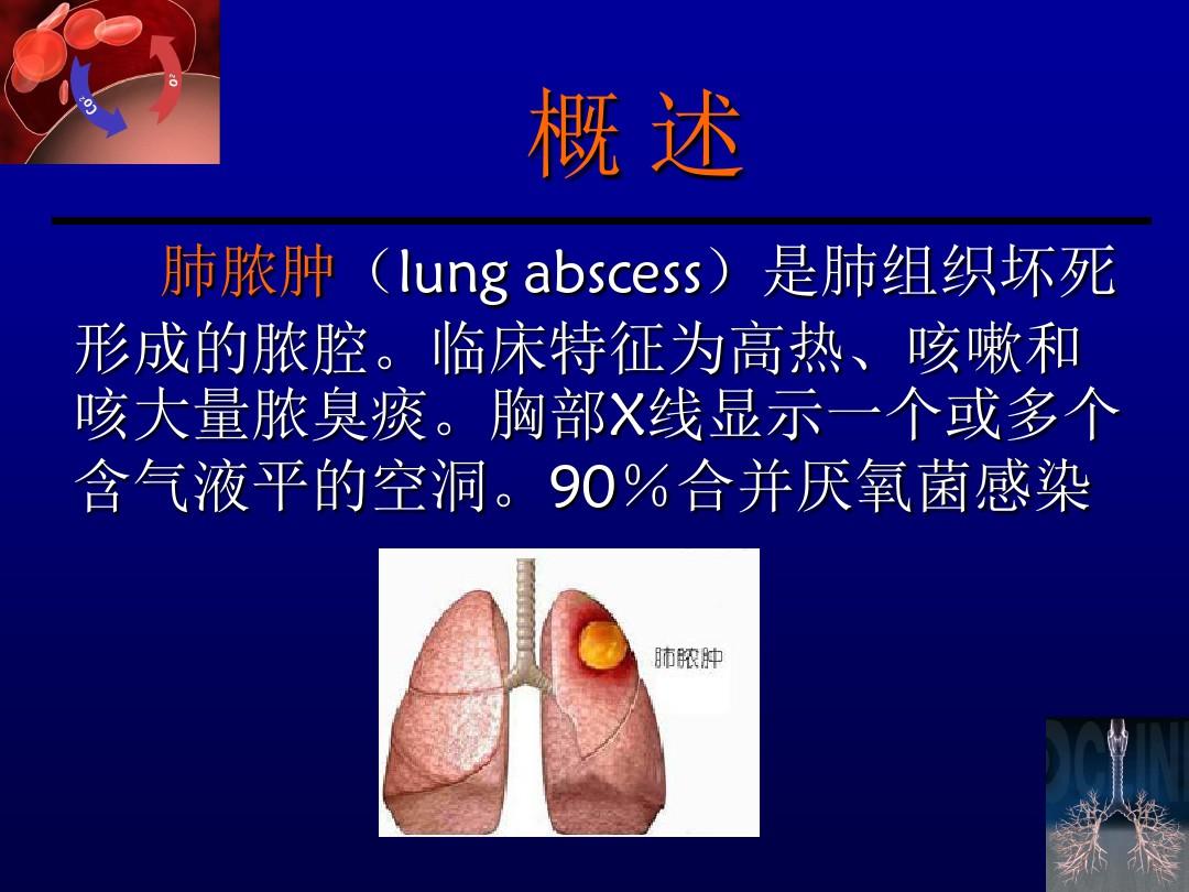 肺脓肿65325ppt课件